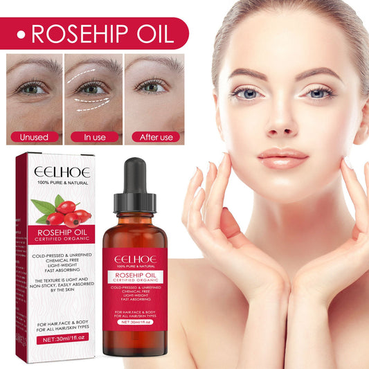 EELHOE Rosehip Facial Oil For Facial And Body Hydration - Rarvelle