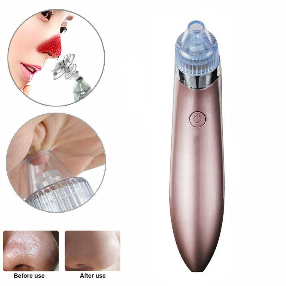 Smart Blackhead Vacuum Pore Cleaner - Rarvelle