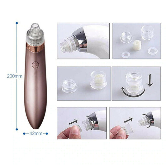Smart Blackhead Vacuum Pore Cleaner - Rarvelle
