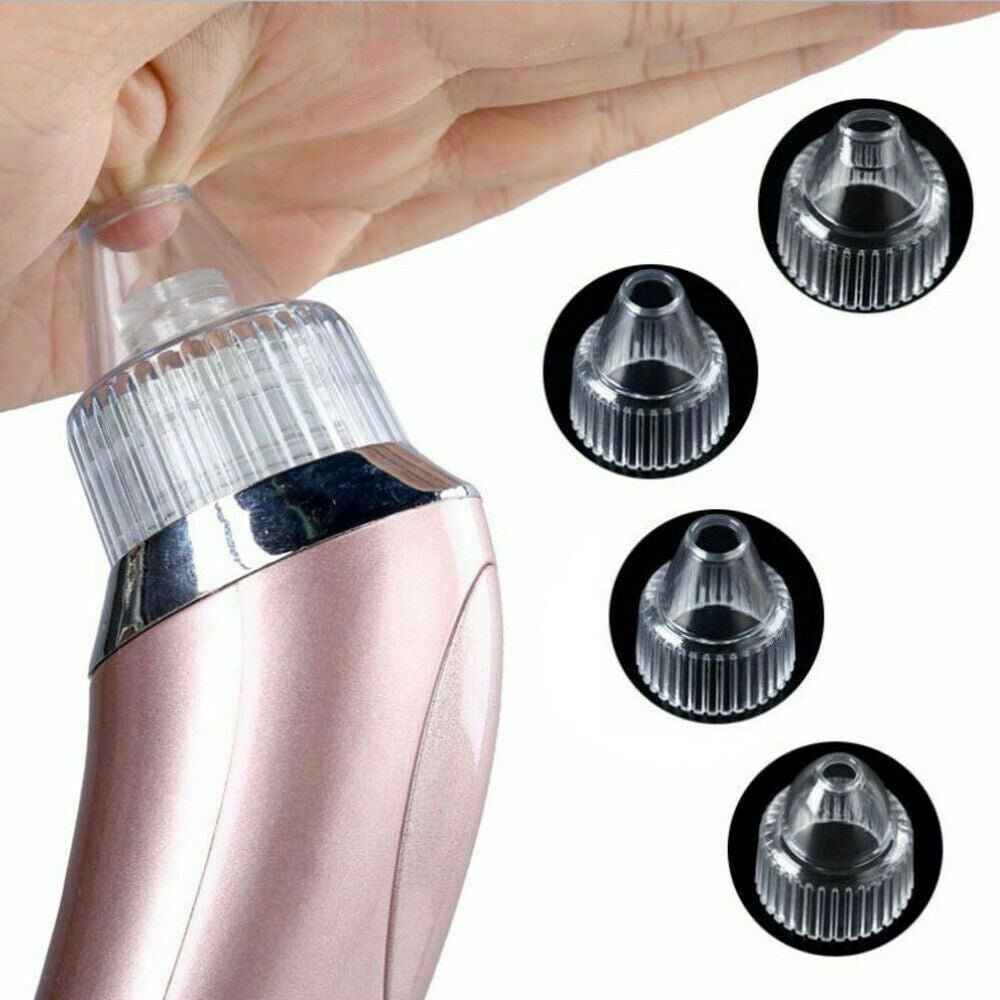 Smart Blackhead Vacuum Pore Cleaner - Rarvelle